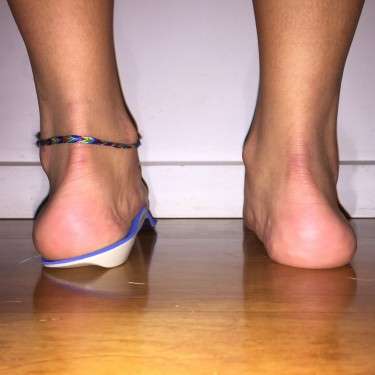 foot orthotics - custom orthotic inserts from Up and Running Podiatry